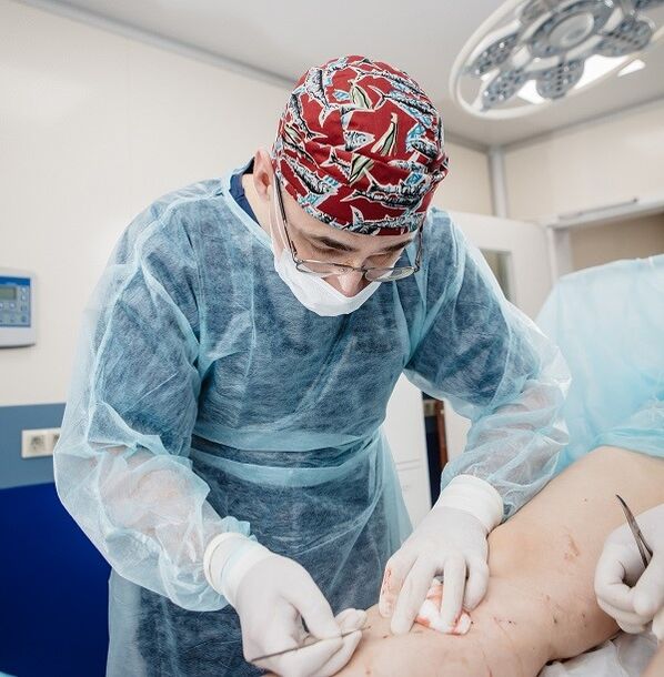 chirurgische Behandlung von Krampfadern