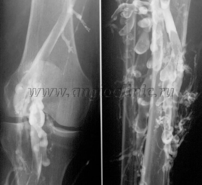 Ultraschalluntersuchung